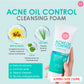 Acne Oil Control Cleansing Foam