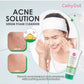 Acne Solution Serum Foam Cleanser