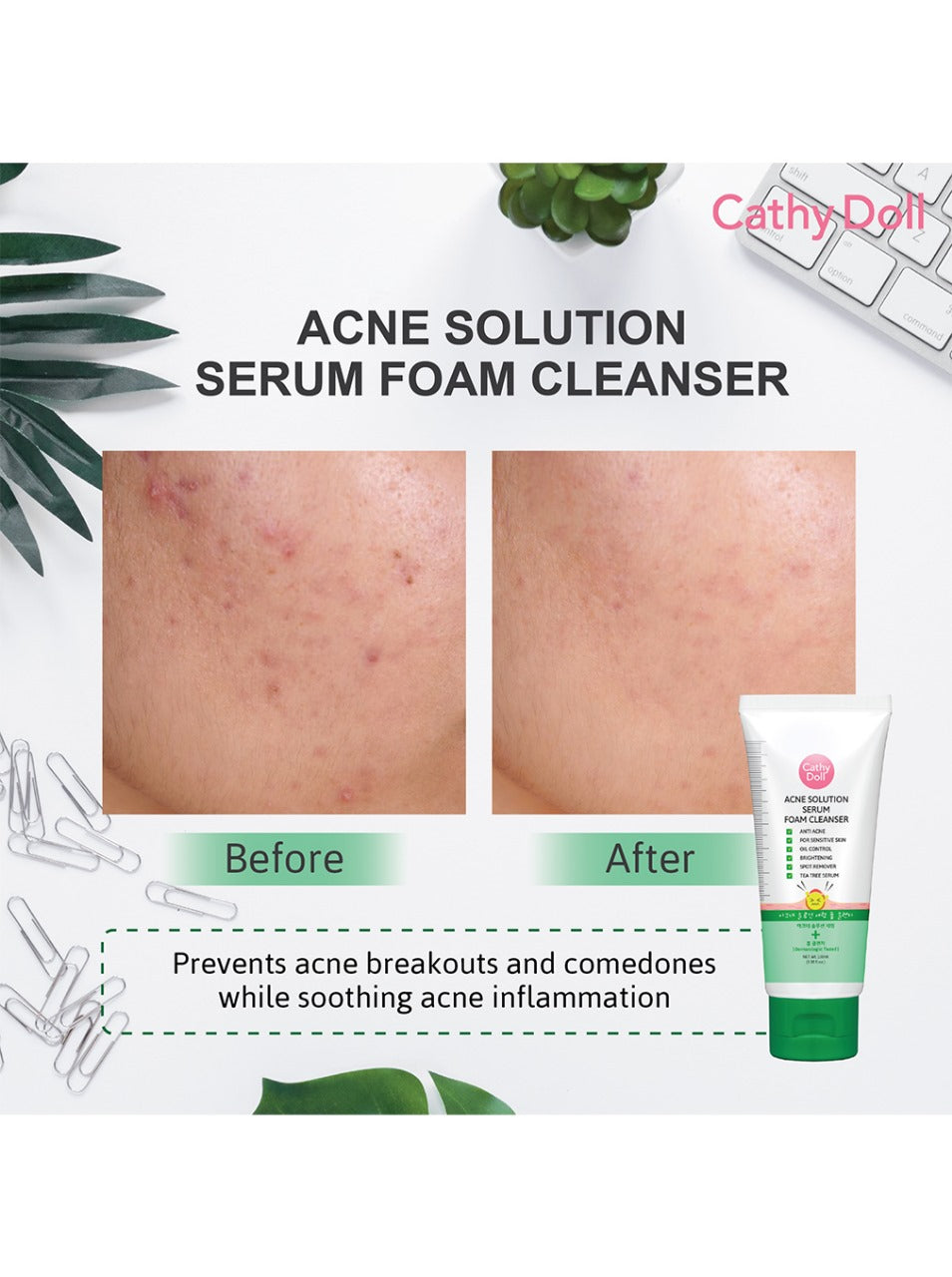 Acne Solution Serum Foam Cleanser